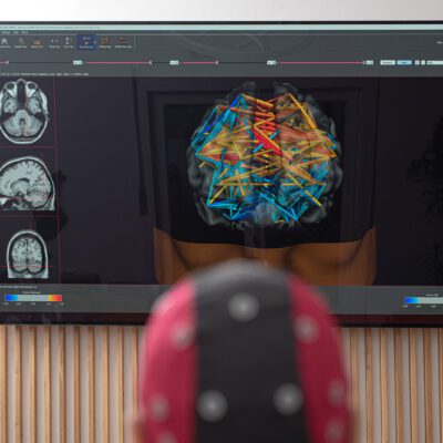 Brain Map Veruvis